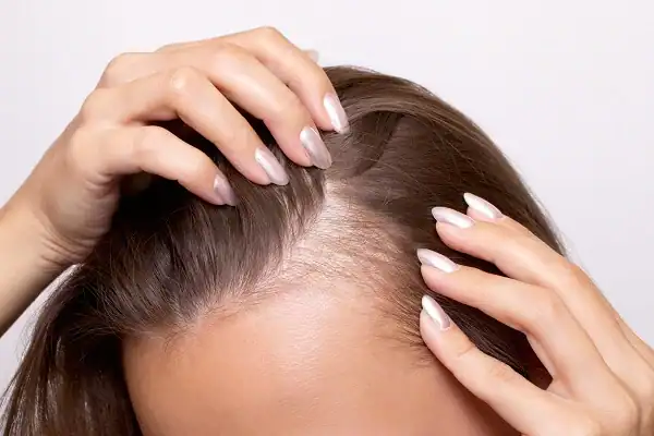 Growth Hormone for Hair Growth
